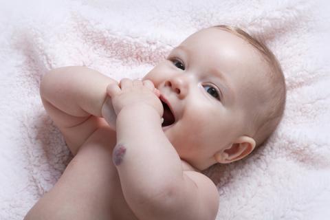 Baby with a birthmark on her arm